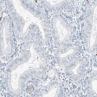 Immunohistochemical staining of human endometrium shows low expression as expected.