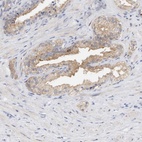 Immunohistochemical staining of human prostate shows high expression.