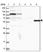 Lane 1: Marker [kDa] 230, 130, 95, 72, 56, 36, 28, 17, 11_br/_Lane 2: Human cell line RT-4_br/_Lane 3: Human cell line U-251MG sp_br/_Lane 4: Human plasma (IgG/HSA depleted)_br/_Lane 5: Human liver tissue_br/_Lane 6: Human tonsil tissue