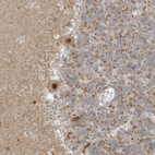 Anti-MSL3 Antibody
