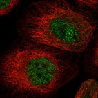 Anti-MSL3 Antibody