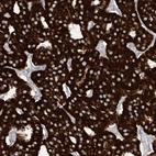 Immunohistochemical staining of human parathyroid gland shows very strong granular cytoplasmic positivity in glandular cells.