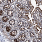 Immunohistochemical staining of human small intestine shows strong cytoplasmic granular positivity in glandular cells.