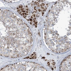 Immunohistochemical staining of human testis shows strong cytoplasmic granular positivity in Leydig cells.