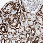 Immunohistochemical staining of human kidney shows very strong cytoplasmic granular positivity in cells in tubules.