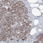 Immunohistochemical staining of human pancreas shows moderate cytoplasmic granular positivity in exocrine glandular cells.