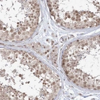 Immunohistochemical staining of human testis shows moderate nuclear positivity in Leydig cells and cells in seminiferous ducts.