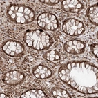 Immunohistochemical staining of human rectum shows strong nuclear positivity in glandular cells.