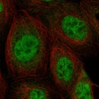 Immunofluorescent staining of human cell line A-431 shows localization to nucleoplasm.