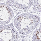 Anti-TGIF2LX Antibody