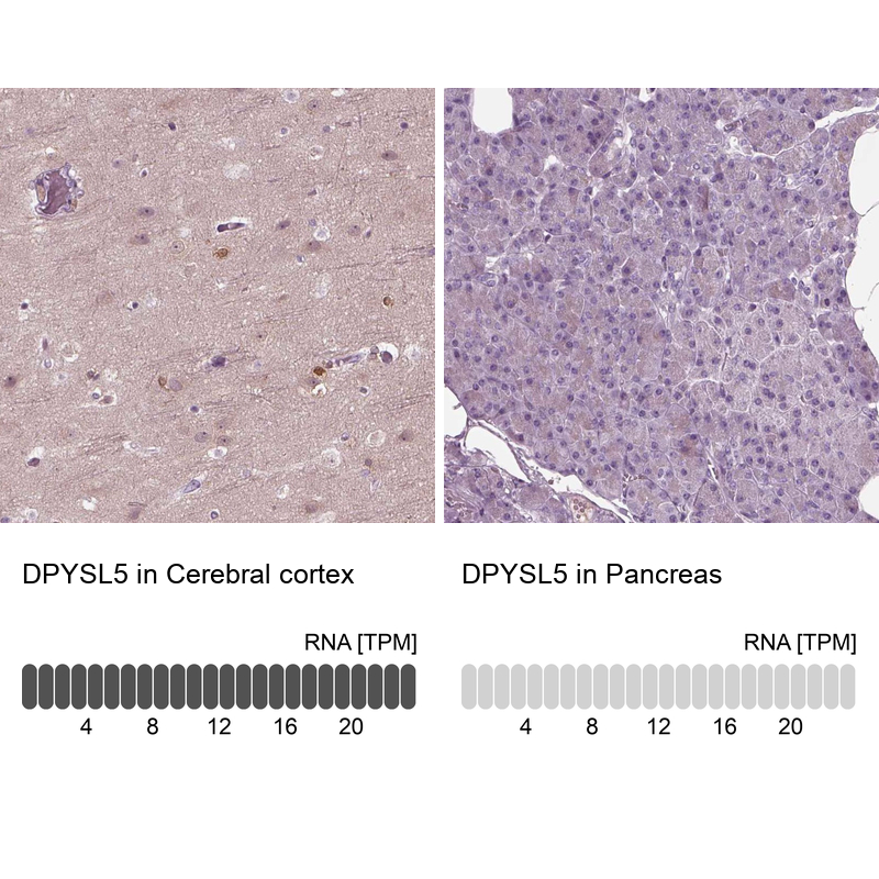 Anti-DPYSL5 Antibody