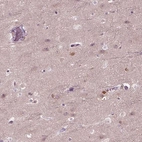 Immunohistochemical staining of human cerebral cortex shows high expression.