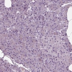 Immunohistochemical staining of human pancreas shows low expression as expected.