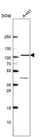 Anti-EXOC6B Antibody