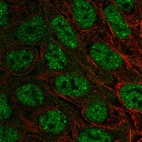 Immunofluorescent staining of human cell line RT4 shows localization to nucleoplasm, nuclear bodies & cytosol.