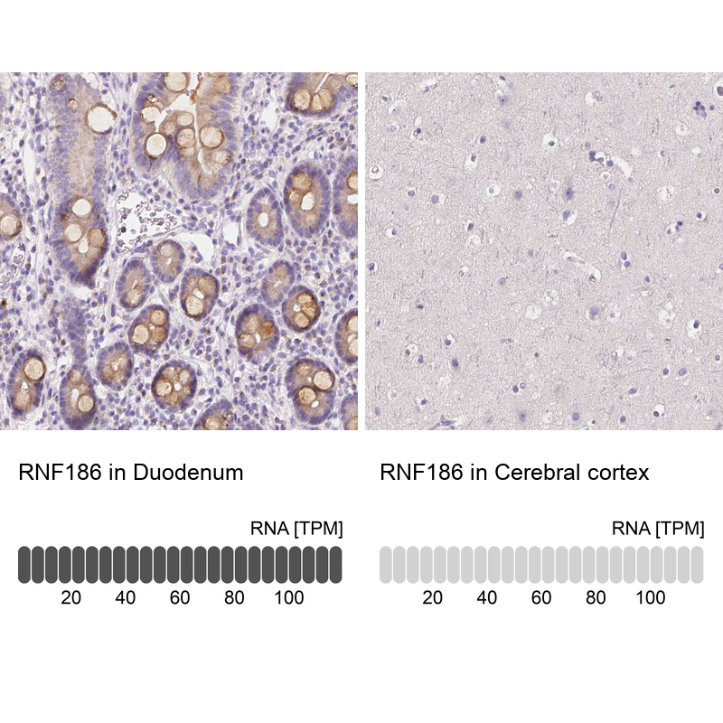 Anti-RNF186 Antibody