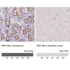 Anti-RNF186 Antibody