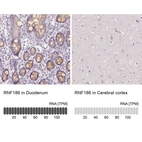 Anti-RNF186 Antibody