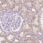 Immunohistochemical staining of human kidney shows weak cytoplasmic positivity in cells in tubules.