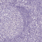 Anti-RNF186 Antibody