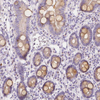 Immunohistochemical staining of human duodenum shows moderate cytoplasmic positivity in goblet cells.