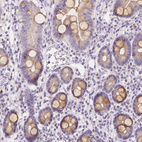 Anti-RNF186 Antibody