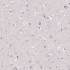 Immunohistochemical staining of human cerebral cortex shows no positivity in neurons as expected.