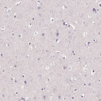 Immunohistochemical staining of human cerebral cortex shows no positivity in neurons as expected.