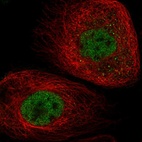 Immunofluorescent staining of human cell line A-431 shows localization to nucleoplasm.