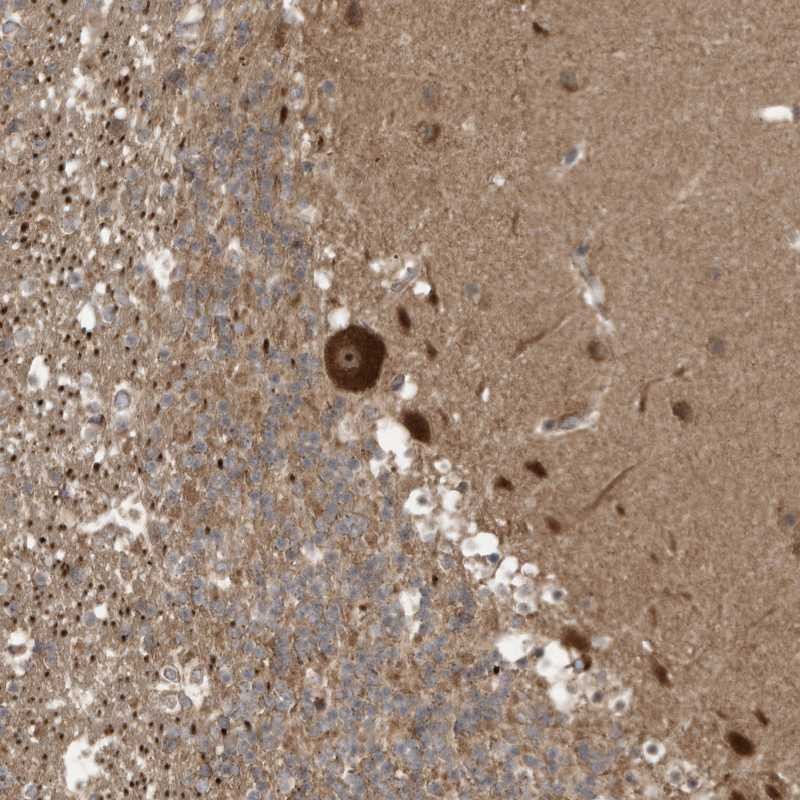Anti-CARF Antibody