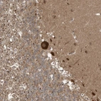 Anti-CARF Antibody