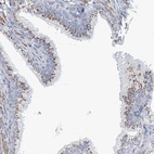 Immunohistochemical staining of human prostate shows strong granular cytoplasmic positivity in glandular cells.