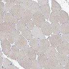 Immunohistochemical staining of human skeletal muscle shows very weak positivity in myocytes.