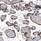 Immunohistochemical staining of human placenta shows strong granular cytoplasmic positivity in trophoblastic cells.