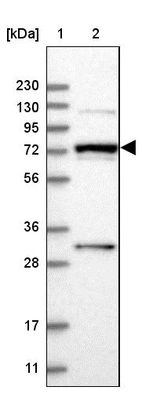 Lane 1: Marker [kDa] 230, 130, 95, 72, 56, 36, 28, 17, 11_br/_Lane 2: Human cell line RT-4