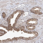 Anti-PDE11A Antibody