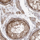 Immunohistochemical staining of human testis shows moderate cytoplasmic positivity in cells in seminiferous ducts and Leydig cells.
