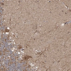 Immunohistochemical staining of human cerebellum shows moderate cytoplasmic positivity in Purkinje cells.