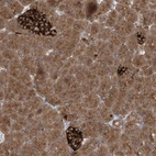 Immunohistochemical staining of human pancreas shows strong cytoplasmic positivity in endocrine glandular cells and moderate cytoplasmic positivity in exocrine glandular cells.
