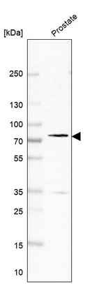 Anti-PDE11A Antibody