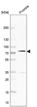 Western blot analysis in human prostate tissue.