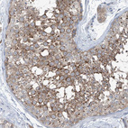 Anti-SLC12A6 Antibody