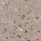 Immunohistochemical staining of human cerebral cortex shows moderate to strong cytoplasmic positivity in neurons.
