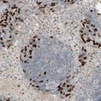 Immunohistochemical staining of human Lymph node shows moderate membranous and cytoplasmic positivity in germinal and non-germinal center cells.