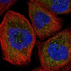 Immunofluorescent staining of human cell line A-431 shows localization to cytosol & vesicles.