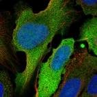Immunofluorescent staining of human cell line U-2 OS shows localization to plasma membrane & cytosol.