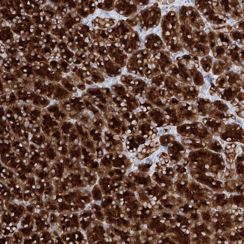 Anti-PPEF1 Antibody