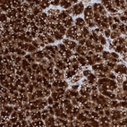 Anti-PPEF1 Antibody