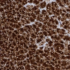 Anti-PPEF1 Antibody