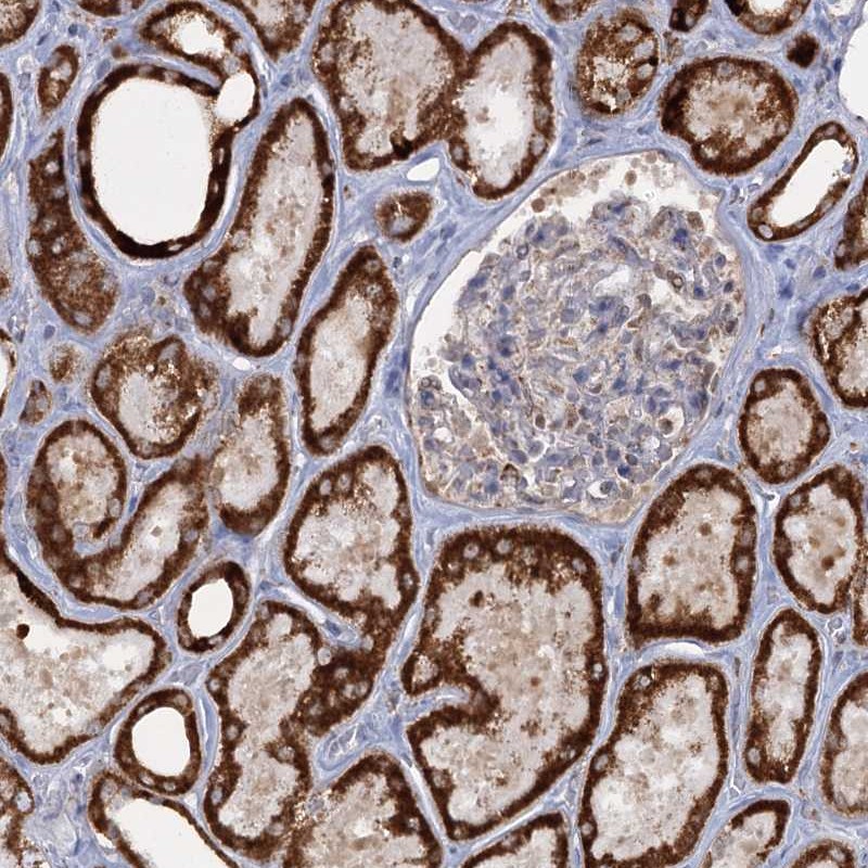 Anti-TAS1R1 Antibody